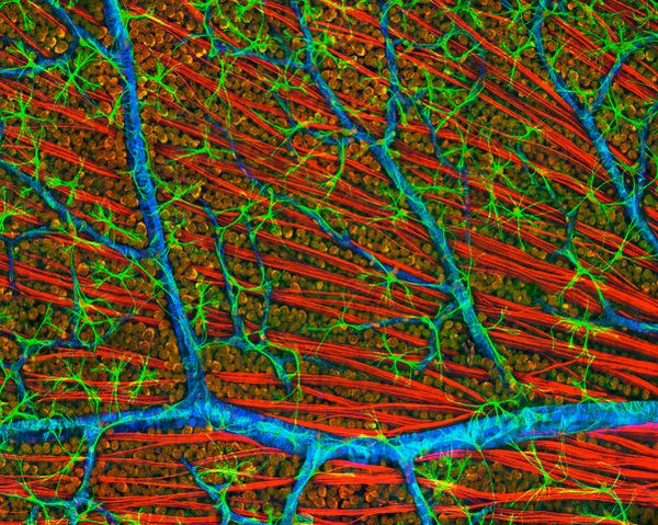 Волокна зрительного нерва (красные), отходящие от сетчатки. Синим окрашен кровеносный сосуд, зелёным — клетки глии, оранжевым — ганглионарные нейроны сетчатки. 