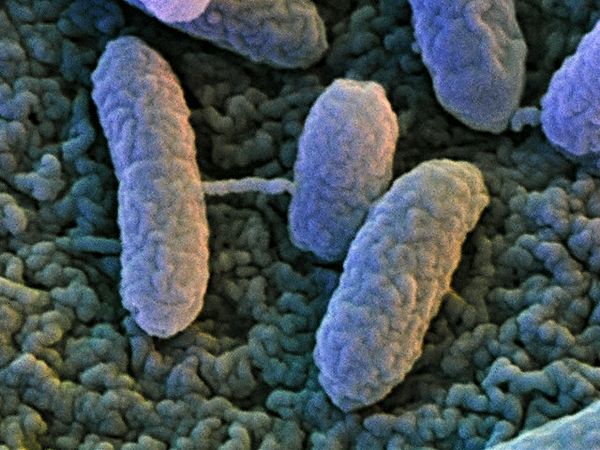 Бактерии рода Salmonella в момент передачи плазмиды 
