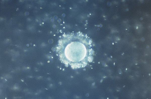 Человеческие яйцеклетка и сперматозоиды в оптическом микроскопе
