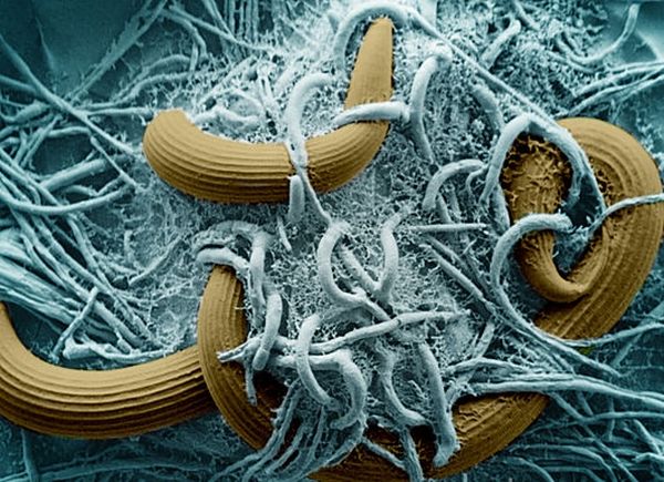 Кольцевые черви в окружении A. oligospora (фото Biophoto Associates / Science Photo Library).