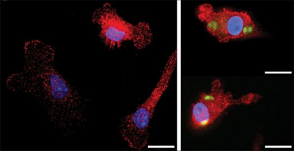 Древовидные клетки: здоровые (слева) и заражённые токсоплазмой (слева) (фото авторов работы).