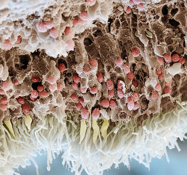Срез через сетчатку: вверху видны тела ганглионарных клеток (бледко-розовые), в центре — тела биполярных нейронов (ярко-розовые), в самом низу — собственно фоторецепторы, палочки и колбочки.