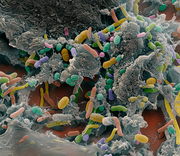 Разные виды бактерий на стенке человеческого кишечника