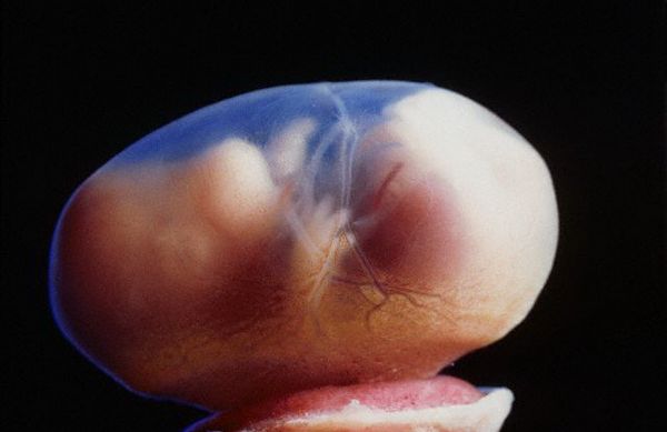 Крысиный эмбрион в возрасте почти 16 дней 